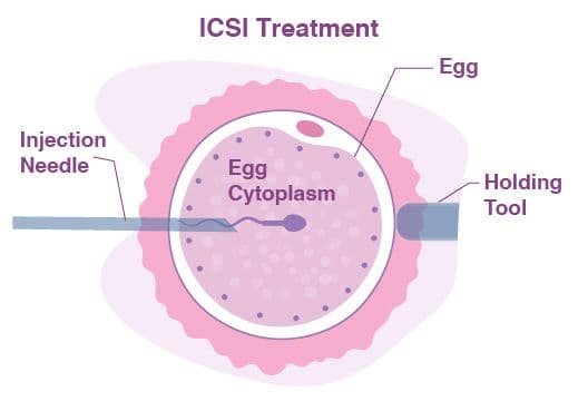 treatment image