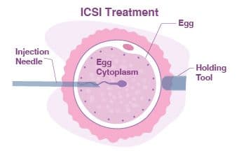 treatment image