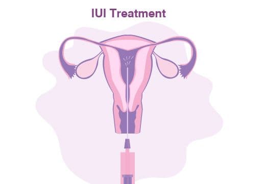 treatment image