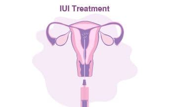treatment image