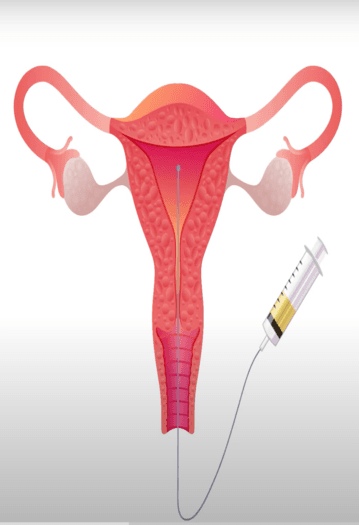 pregnancyplan1